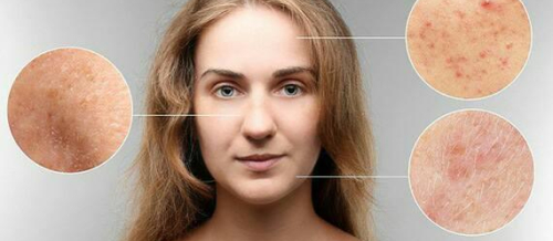 Dermatologiya, Dəri xəstəlikləri, Dermatoloji, Aknenin müalicəsi, Dermatoveneroloq