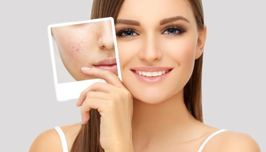 Dermatoloq həkim, Dermatologiya nədir, Dermatoloq nədir, Dermatologiya mütəxəssisi