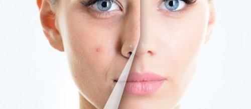 Dəri Xəstəliklərinin Yaranma Səbəbləri, Dermatoloq, kosmetik dermatologiya, Dermatologiya mütəxəssisi