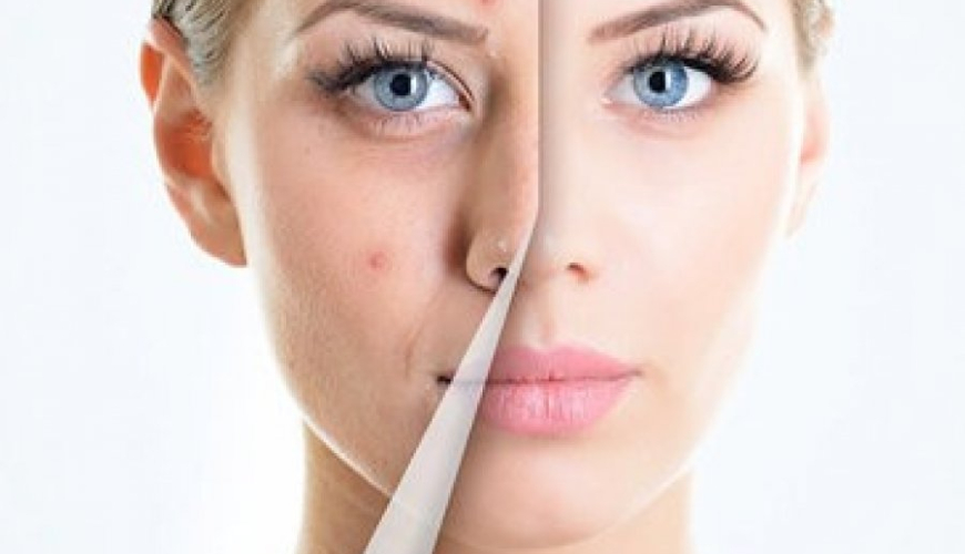 Dəri Xəstəliklərinin Yaranma Səbəbləri, Dermatoloq, kosmetik dermatologiya, Dermatologiya mütəxəssisi