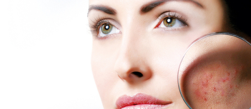 Dəri Xəstəliklərinin Yaranma Səbəbləri, Dermatoloq, kosmetik dermatologiya, Dermatologiya mütəxəssisi