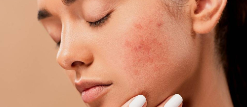 Dermatovenerologiya, Dəri xəstəliklərinin müalicəsi, Dəri xəstəliklərini yaradan səbəblər, Dəri xəstəliklərinin əlamətləri