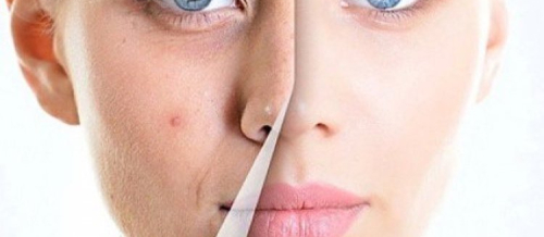 Dermatologiya nədir, Dəri xəstəlikləri, Dermatoloji, Dermatologiya və kosmetologiya, Dermatoloq
