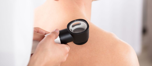 Dermatologiya nədir, Dəri xəstəlikləri, Dermatoloji, Dermatologiya və kosmetologiya, Dermatoloq