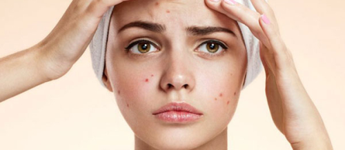 Dermatokosmetik prosedurlar, Dermatoloq, mezoterapiya, Üzdə səpgilər, Akne