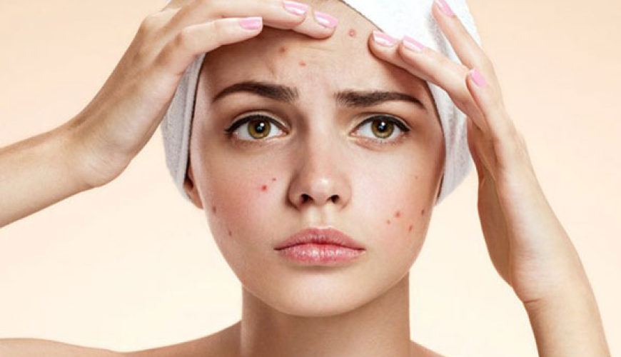 Dermatokosmetik prosedurlar, Dermatoloq, mezoterapiya, Üzdə səpgilər, Akne