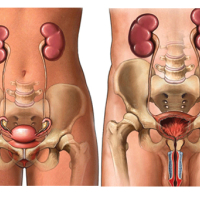 Andrologiya, Androloji problemlər, Urologiya və Andrologiya, Cinsi zəifliyin səbəbləri