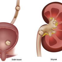 Andrologiya, Androloji problemlər, Urologiya və Andrologiya, Cinsi zəifliyin səbəbləri