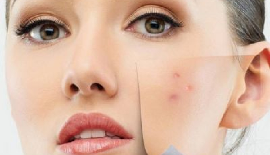 Dermatologiya, Dəri problemləri, Dəri xəstəliklərinin diaqnostikası və müalicəsi, Kosmetik Dermatologiya