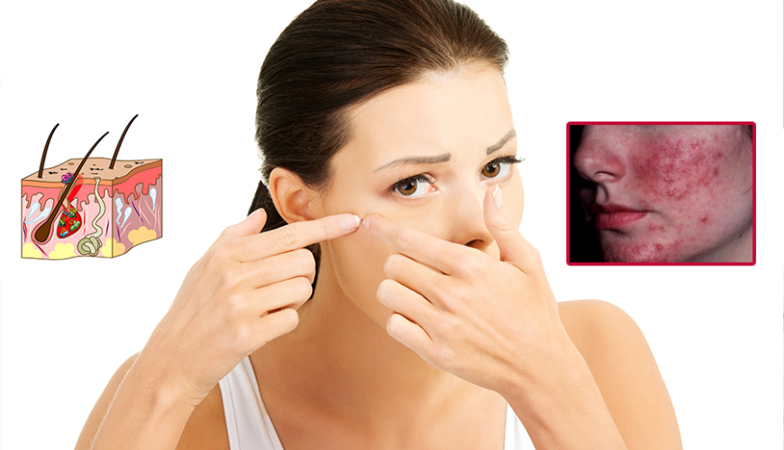 Dəri xəstəlikləri, Müasir dermatologiya, Dermatologiya problemləri, Dermatoloji xəstəliklərin diaqnostikası, Dəri xəstəliklərinin müalicəsi