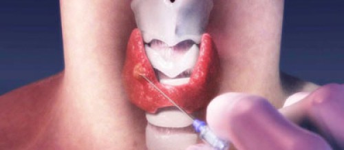 Endokrin xəstəliklər, Endokrin sistemi, Endokrinologiya, Endokrinologiya nədir, Endokrin vəzlər, endokrin xəstəliklər