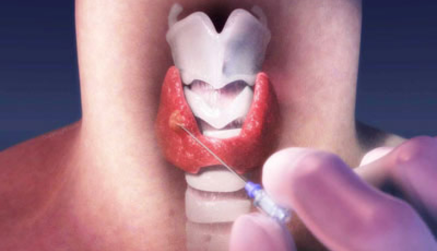 Endokrin xəstəliklər, Endokrin sistemi, Endokrinologiya, Endokrinologiya nədir, Endokrin vəzlər, endokrin xəstəliklər