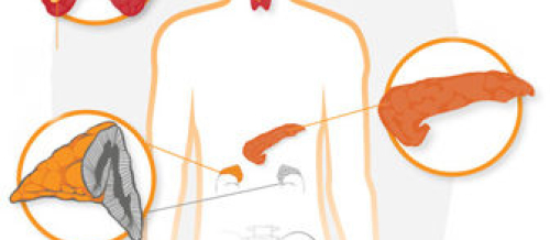 Endokrinologiya, Şəkərsiz diabet, endokrinoloji, Şəkərli Diabet, Endokrin sonsuzluq