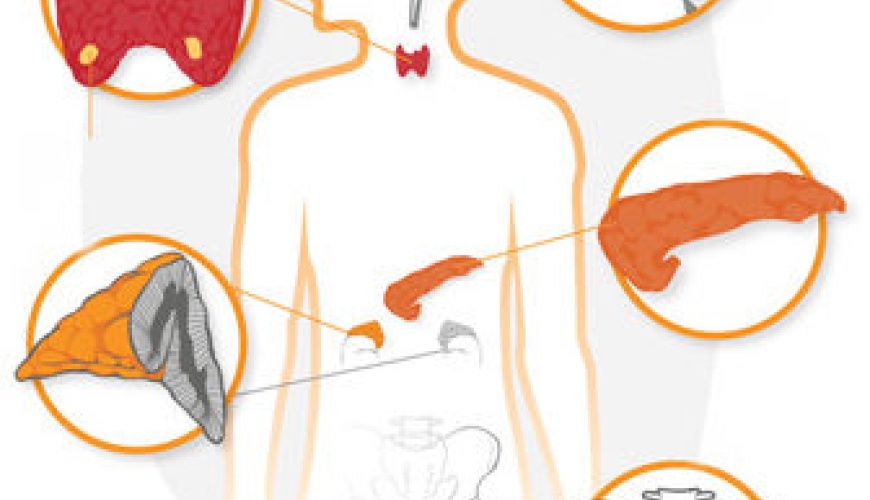 Endokrinologiya, Şəkərsiz diabet, endokrinoloji, Şəkərli Diabet, Endokrin sonsuzluq