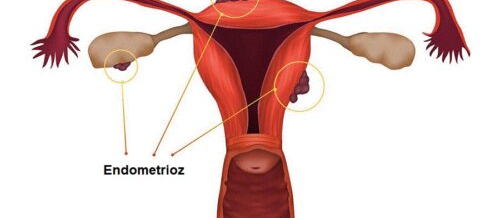 Ginekologiya, Ginekoloq, Mama Ginekoloq, Ginekologiya nədir, cinsi xəstəliklər
