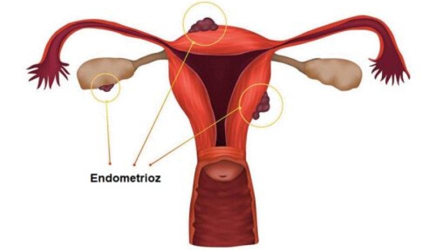 Ginekologiya, Ginekoloq, Mama Ginekoloq, Ginekologiya nədir, cinsi xəstəliklər