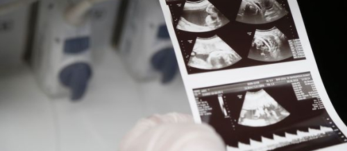 Mamalıq və Ginekologiya, Ginekologiya şöbəsi, Hamiləlik və Doğum, Hamiləlik öncəsi müayinə