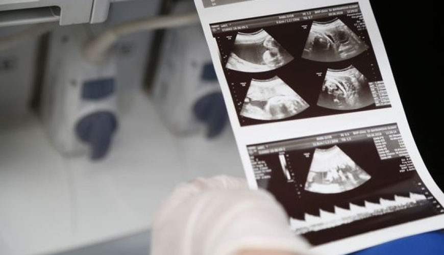 Mamalıq və Ginekologiya, Ginekologiya şöbəsi, Hamiləlik və Doğum, Hamiləlik öncəsi müayinə