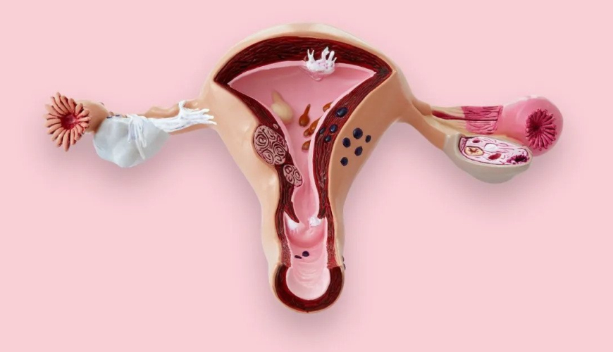 Ginekologiya və mamalıq, ginekoloogiyanın sahələri, ginekoloji müayinə