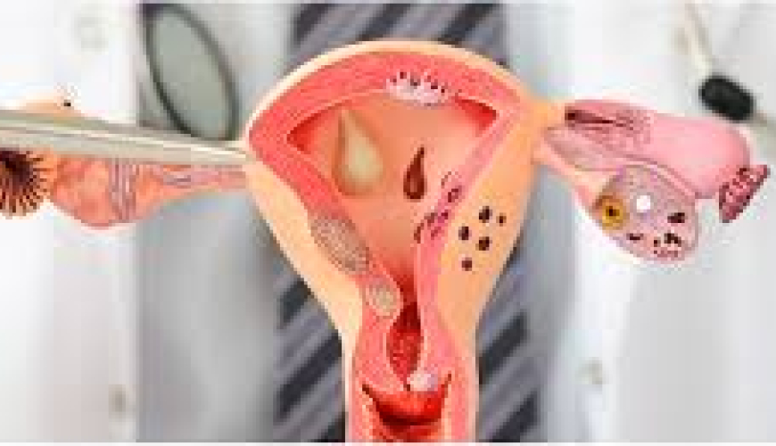 Ginekologiya nədir, ginekoloji xəstəliklər, ginekoloq, ginekoloji müayinə, ginekoloji müalicə