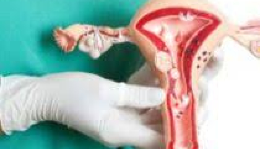 Qadın cinsi xəstəlikləri, ginekoloji xəstəliklər, mama ginekoloq, ginekoloji müayinə, ginekoloji müalicə, ginekoloji yoxlanış