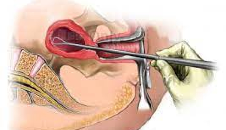 Qadın cinsi xəstəlikləri, ginekoloji xəstəliklər, mama ginekoloq, ginekoloji müayinə, ginekoloji müalicə, ginekoloji yoxlanış