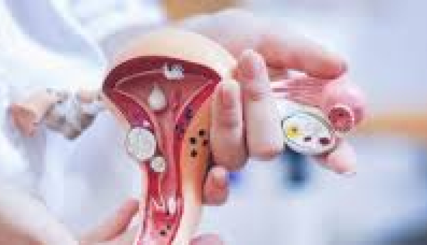 Ginekoloji müayinə, qadın xəstəlikləri, ginekoloq, ginekoloji müalicə