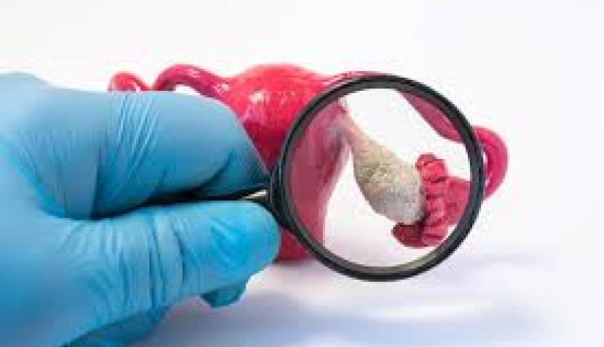 ginekoloji xəstəliklər, qadın xəstəlikləri, ginekoloji analizlər, ginekoloji suallar, ginekoloq