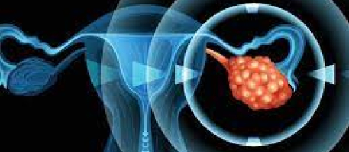 Hamilə qalmağın üsulları, menstruasiya, ginekoloji xəstəliklər, ginekoloji müalicə