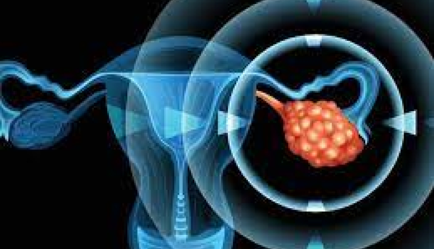 Hamilə qalmağın üsulları, menstruasiya, ginekoloji xəstəliklər, ginekoloji müalicə