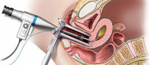 Ginekologiya, ginekoloji xəstəliklər, ginekoloji müayinə, ginekoloji müalicə, qadın xəstəlikləri