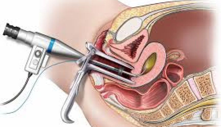 Ginekologiya, ginekoloji xəstəliklər, ginekoloji müayinə, ginekoloji müalicə, qadın xəstəlikləri