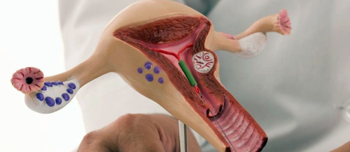 Sonsuzluq nədir, Qadın sonsuzluğu nədən yarana bilər, Anadangəlmə anomaliyalar, Sonsuzluğun diaqnostikası