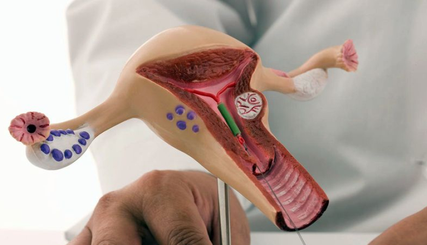 Sonsuzluq nədir, Qadın sonsuzluğu nədən yarana bilər, Anadangəlmə anomaliyalar, Sonsuzluğun diaqnostikası