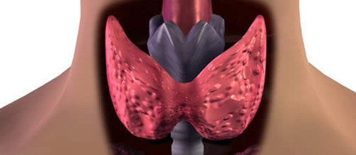 Hamiləlikdə zob, Hamiləlikdə zob səbəbləri, Hamiləlikdə zob əlamətləri, Tiroid hormonları, hipotiroidizm