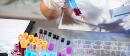 Qan analizi, Laboratoriya xidməti, Hamiləlikdə qan analizi, Laboratoriya analizi