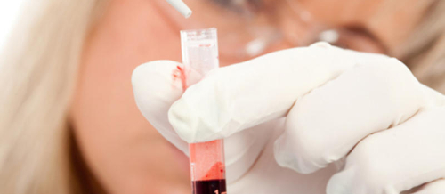 Ümumi qan analizi, Qanın klinik analizi, Hemoqlobin, Laborator müayinələr, Laboratoriya nəticələri