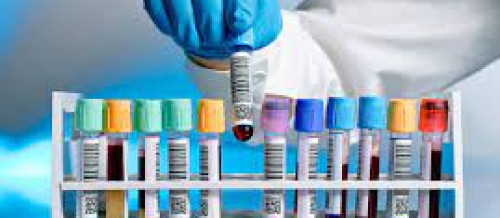 Laboratoriya, laborator müayinə, laboratoriya analizləri, laboratoriya analiz nəticələri