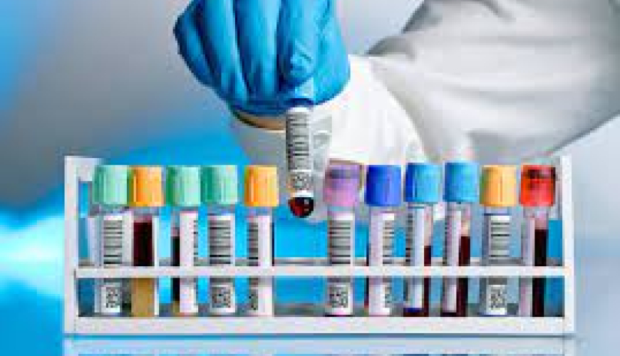 Laboratoriya, laborator müayinə, laboratoriya analizləri, laboratoriya analiz nəticələri