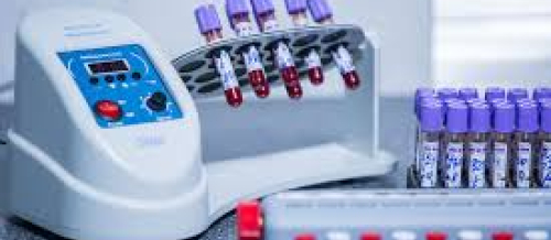 Biokimyəvi analizləri, laboratoriya analizləri, laboratoriya neticeleri, laboratoriya xidmeti