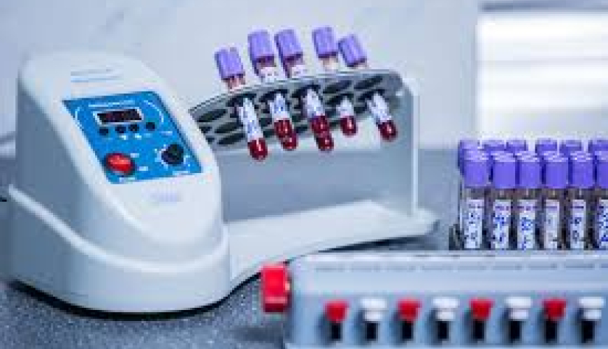 Biokimyəvi analizləri, laboratoriya analizləri, laboratoriya neticeleri, laboratoriya xidmeti