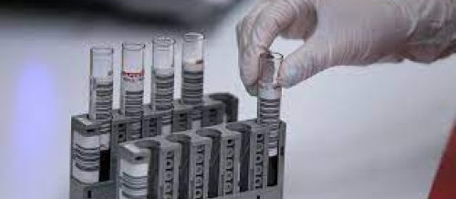 Biokimyəvi analizləri, laboratoriya analizləri, laboratoriya neticeleri, laboratoriya xidmeti