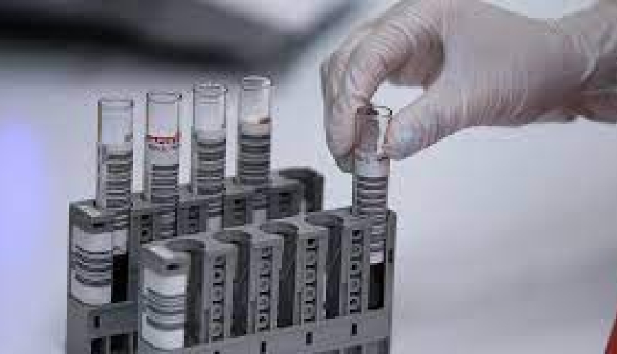 Biokimyəvi analizləri, laboratoriya analizləri, laboratoriya neticeleri, laboratoriya xidmeti