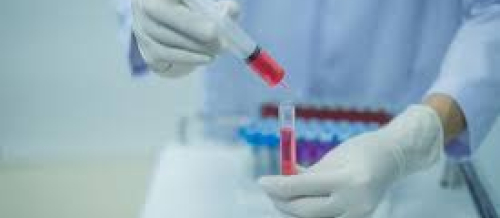 Biokimyəvi analizləri, laboratoriya analizləri, laboratoriya neticeleri, laboratoriya xidmeti