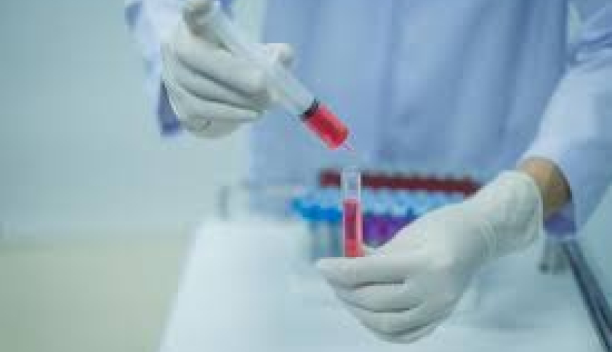 Biokimyəvi analizləri, laboratoriya analizləri, laboratoriya neticeleri, laboratoriya xidmeti