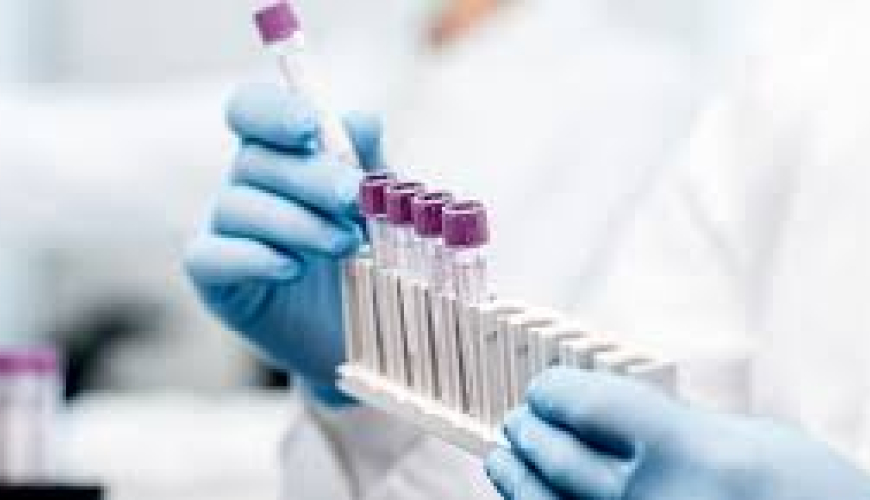 Laboratoriya, laboratoriya xidməti, laboratoriya şöbəsi, laboratoriya analizi