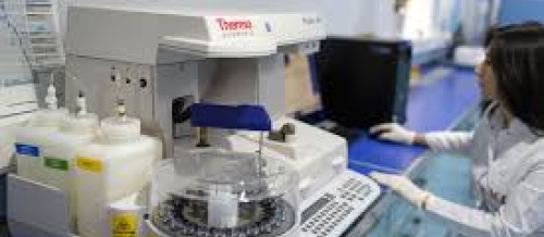 Qan analizi, ümumi qan analizi, Laboratoriya analizi, Ümumi qan analizi necə aparılır, Analiz