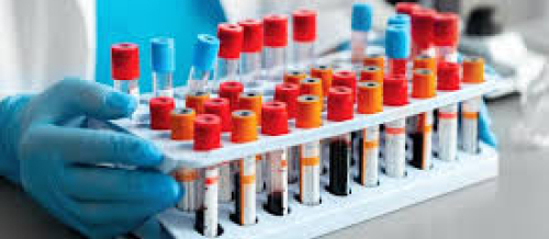 Tibbi laboratoriya texnikaları, laboratoriya xidmətləri, laboratoriya analizləri