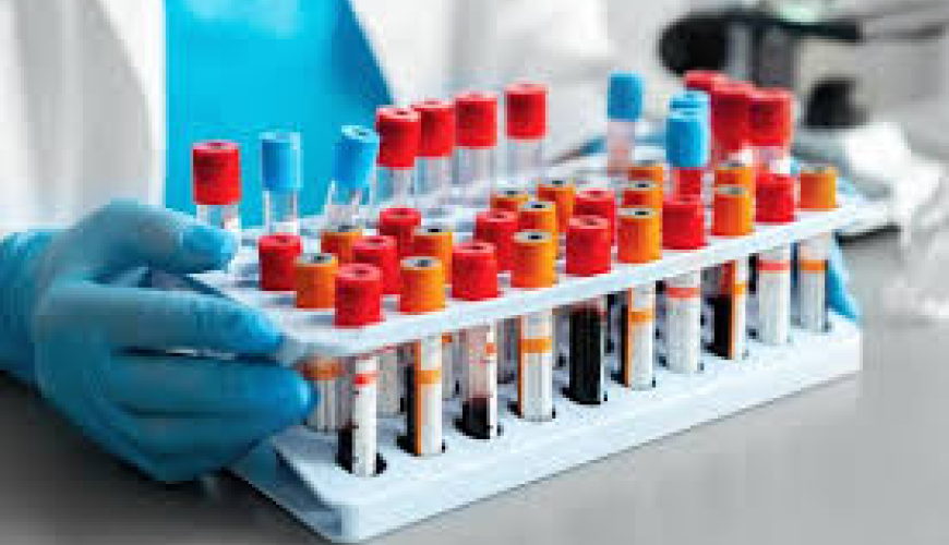 Tibbi laboratoriya texnikaları, laboratoriya xidmətləri, laboratoriya analizləri