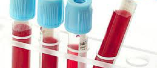 Klinik biokimya, klinik mikrobiologiya, laboratoriya analizləri, laboratoriya xidmətləri